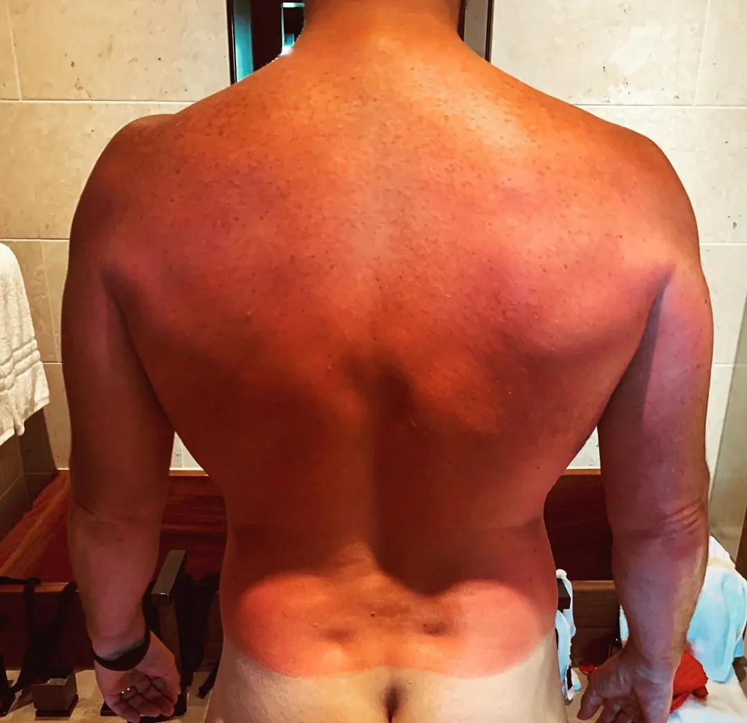 Ο Κρις προετοίμασε να παρακολουθήσει το σκοτεινό YD