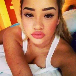 12-Kim-Johansson-vuotanut-alaston-rasva