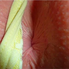 10-Melissa-Johns-Nude-Naked-Leaked