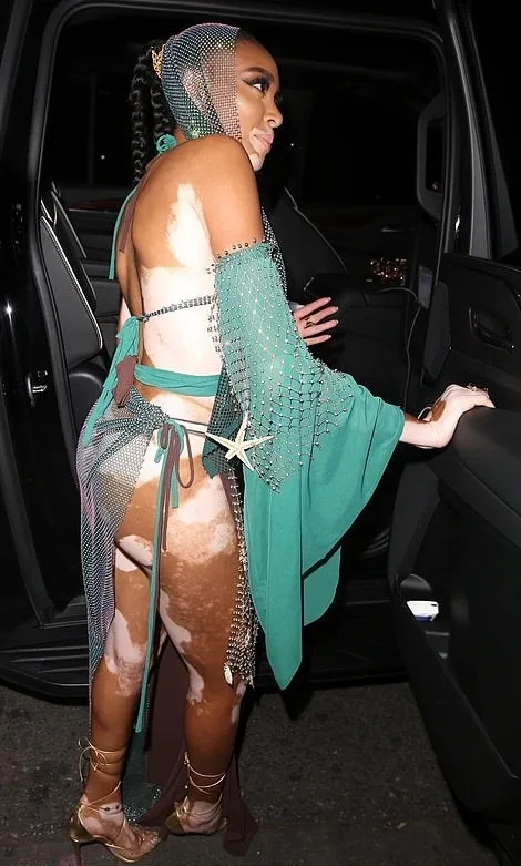 Winnie Harlow Ass